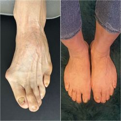 Cd'a Foot and Ankle Clinic