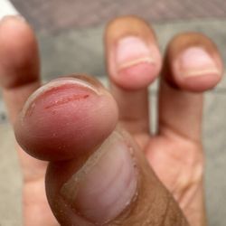 Nail Boutique - Deep cut from aggressive service.