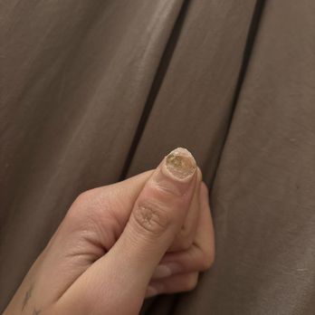 Zara Nails Lounge - Fungal/Bacterial Growth - Nail Salons Near Me - Santa Ana, California Zara Nails Lounge - Fungal/Bacterial Growth - Nail Salons Near Me - Santa Ana, California