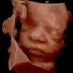 Hello Baby 4D Ultrasound Studio