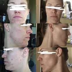 The Wax Lady - Where I started 12 years ago. Second pic is 4 months later.