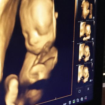 Picture Perfect 3D 4D - My first grandson! - Ultrasound Imaging Centers Near Me - Houston, Texas Picture Perfect 3D 4D - My first grandson! - Ultrasound Imaging Centers Near Me - Houston, Texas