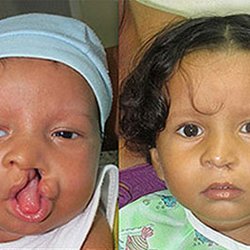 New York Center for Facial Plastic Surgery