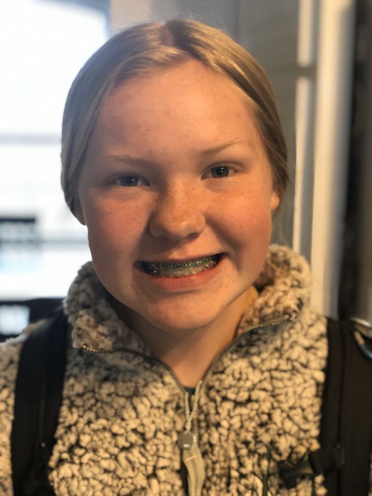 ORTHODONTICS BY BIRTH & FLETCHER IN BURLESON 27 Photos 109 W Renfro