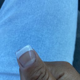 Fucked up nail