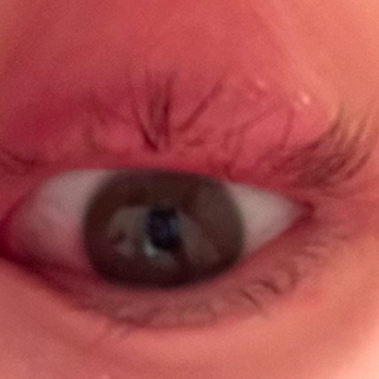 Blossom Brows Threading Salon - Infected lash lift - Skin Care Near Me - Brooklyn, New York Blossom Brows Threading Salon - Infected lash lift - Skin Care Near Me - Brooklyn, New York