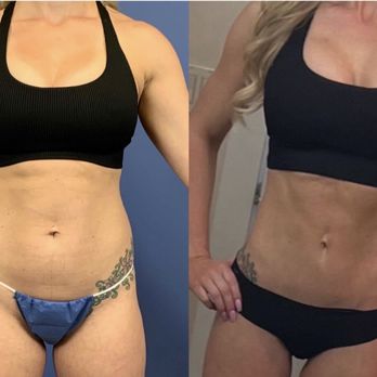 York Yates Plastic Surgery - Cosmetic Surgeons Near Me - Layton, Utah York Yates Plastic Surgery - Cosmetic Surgeons Near Me - Layton, Utah