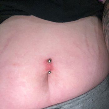 Crimson Heart Studio - Heres what my piercing looks like three months later. No salt. So they can't even say that this is burning. - Piercing Near Me - Federal Way, Washington Crimson Heart Studio - Heres what my piercing looks like three months later. No salt. So they can't even say that this is burning. - Piercing Near Me - Federal Way, Washington