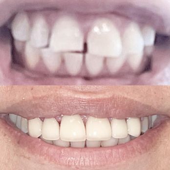 Gateway Dental Group - Oral Surgeons Near Me - Fairfield, California Gateway Dental Group - Oral Surgeons Near Me - Fairfield, California