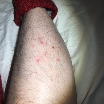 Big Horn Lodge - Bed bugs! - Hotels Near Me - Moab, Utah