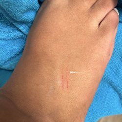 Fancy Nails - Very painful