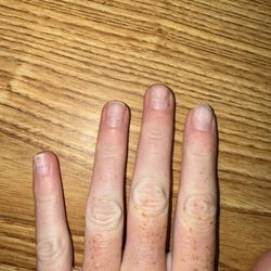 Pinky's Nails 4 - Acrylic removal results