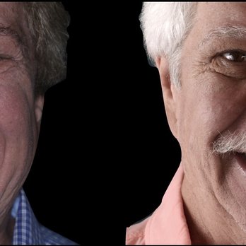 Artlab Dentistry - All on X full mouth implant reconstruction. Life changing - General Dentistry Near Me - Los Angeles, California