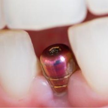 Bonnie Doon Denture Clinic - Health & Medical Near Me - Edmonton, Alberta Bonnie Doon Denture Clinic - Health & Medical Near Me - Edmonton, Alberta