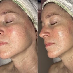 Face Integrity