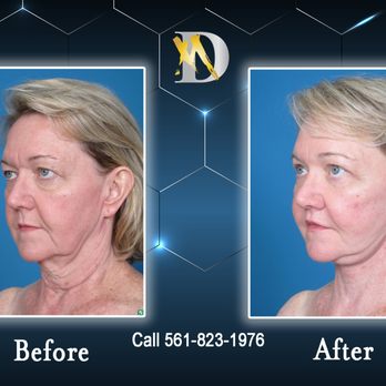 Daniel Man, MD - Medical Spas Near Me - Boca Raton, Florida Daniel Man, MD - Medical Spas Near Me - Boca Raton, Florida