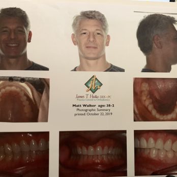 James T Hutta, DDS - Orthodontics Exam - Orthodontists Near Me - Gahanna, Ohio