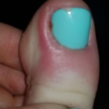 Nail Paradise - My toe was cut with a cuticle trimmer and less than 24 hours later severely infected. - Nail Salons Near Me - Spokane, Washington