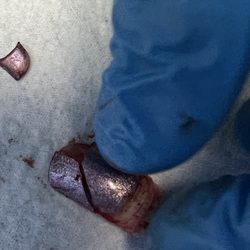 SmartClinic Urgent Care - My nails