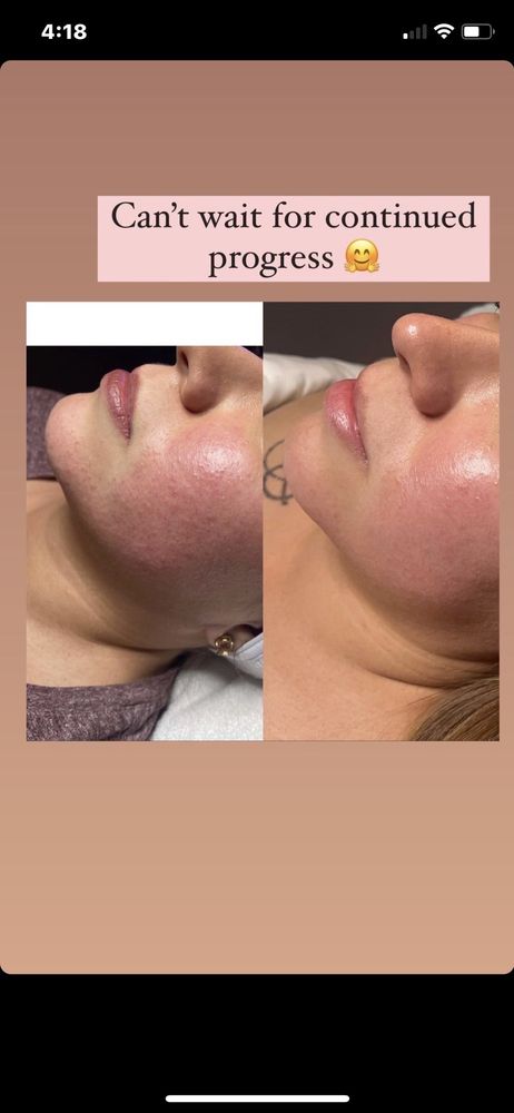 AV Skincare by Kristina Logo