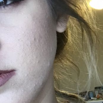 Skin Studio AZ - Make Up on my SUPER textured skin before any sessions or even considering microneedling - Skin Care Near Me - Scottsdale, Arizona Skin Studio AZ - Make Up on my SUPER textured skin before any sessions or even considering microneedling - Skin Care Near Me - Scottsdale, Arizona