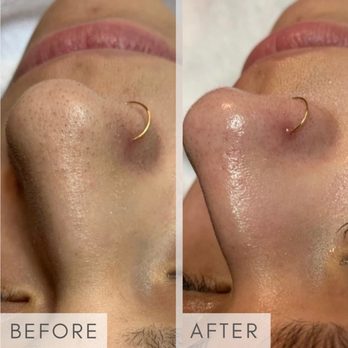 Derma Bliss - Medical Spas Near Me - Chicago, Illinois