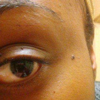 Cali Nails - Ripped skin from waxing - Nail Salons Near Me - Manhattan, Kansas Cali Nails - Ripped skin from waxing - Nail Salons Near Me - Manhattan, Kansas