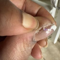 The Nail Company - 24hours after $62 pedicure. Asked them to fix it while I was there and the male tech yelled at me and refused.
