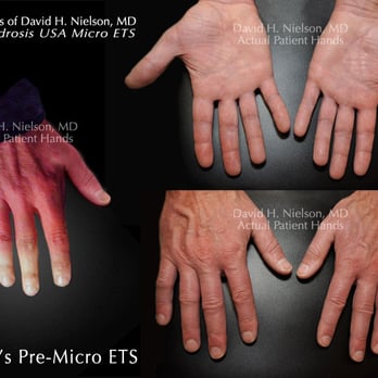 David H Nielson, MD - Surgeons Near Me - San Antonio, Texas David H Nielson, MD - Surgeons Near Me - San Antonio, Texas