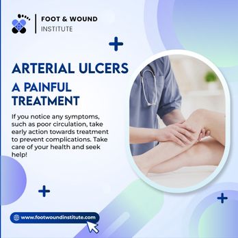 Foot Wound Institute - Home Health Care Near Me - Matteson, Illinois Foot Wound Institute - Home Health Care Near Me - Matteson, Illinois