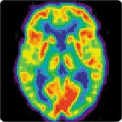 Simon Tan, PsyD, ABPP-CN - grief counselor in Belmont, CA