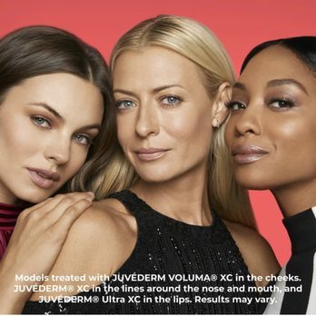 MedSpa MANGO - Juvederm fillers for jaw, cheek bones, lips, nasal lab. folds and more! - Laser Hair Removal Near Me - Scottsdale, Arizona MedSpa MANGO - Juvederm fillers for jaw, cheek bones, lips, nasal lab. folds and more! - Laser Hair Removal Near Me - Scottsdale, Arizona