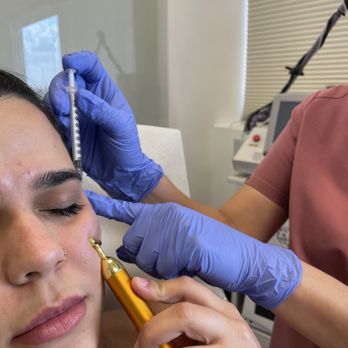Universal Laser Center - Laser Hair Removal Near Me - Miami, Florida