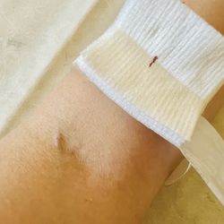 Quest Diagnostics - Alyssa used a butterfly needle with excellent skill. Almost no bleeding or bruising afterward. Thank you, Alyssa!