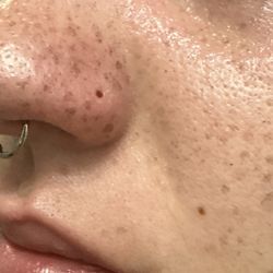 Ago Fine Jewelry and Piercing - Hole left after i took out nose piercings