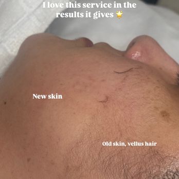 Natural Aura Skin - Estheticians Near Me - Highland, California Natural Aura Skin - Estheticians Near Me - Highland, California