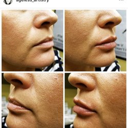Pearl Medspa - So natural!