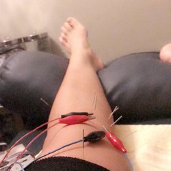 Fixing my knee dr Han is amazing!