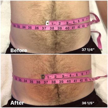Lightbeauty Cryo - Cryotherapy Near Me - Birmingham, Michigan Lightbeauty Cryo - Cryotherapy Near Me - Birmingham, Michigan