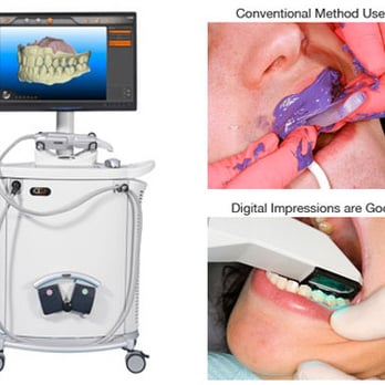 Paramount Orthodontics - Julia Choi DMD - No more messy and uncomfortable impressions for your Invisalign treatment! - Orthodontists Near Me - Downey, California Paramount Orthodontics - Julia Choi DMD - No more messy and uncomfortable impressions for your Invisalign treatment! - Orthodontists Near Me - Downey, California