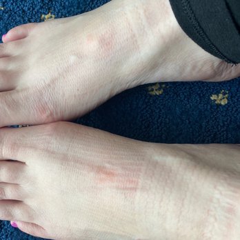 USA Nails - Redness from abrasive irritation on top of foot. This was after it calmed down some. - Nail Salons Near Me - Columbia, South Carolina