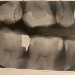 Perry Family Dental Care