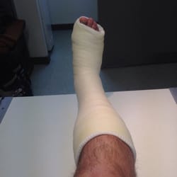 Centre Médical Argentière - Undisplaced exterior malleous fracture repair
