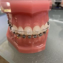 Collins Orthodontics - Teeth!!!!