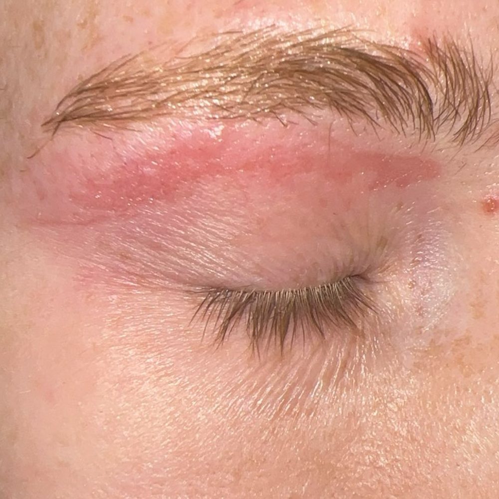 burned my eyebrow.
