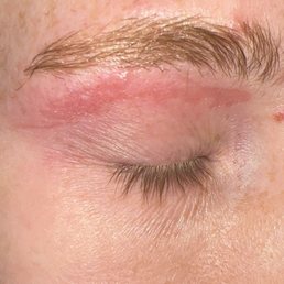 burned my eyebrow. burned my eyebrow.