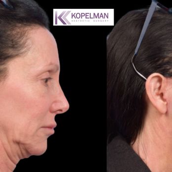 Kopelman Aesthetic Surgery - Cosmetic Surgeons Near Me - Paramus, New Jersey