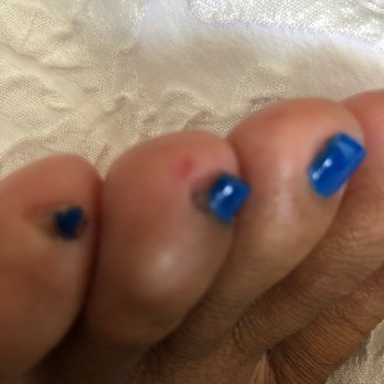 First Class Nails & Spa - Cut on my toe from service. - Waxing Near Me - South Orange, New Jersey