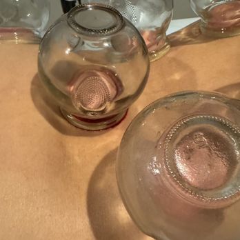 QQ Body Work - We offer complimentary cupping as an add-on to your treatment, if you'd like. - Massage Therapy Near Me - New York, New York