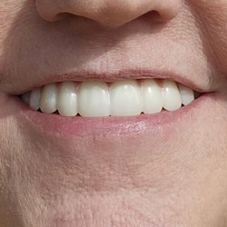 Ace Dental Center - I can finally smile again.